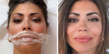 ''Oggi sto per fare una cosa che non ho mai fatto'': Flora Canto annuncia il suo ‘ritocchino speciale’ sui social